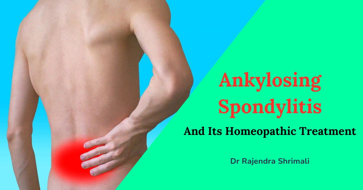 What is Ankylosing Spondylitis