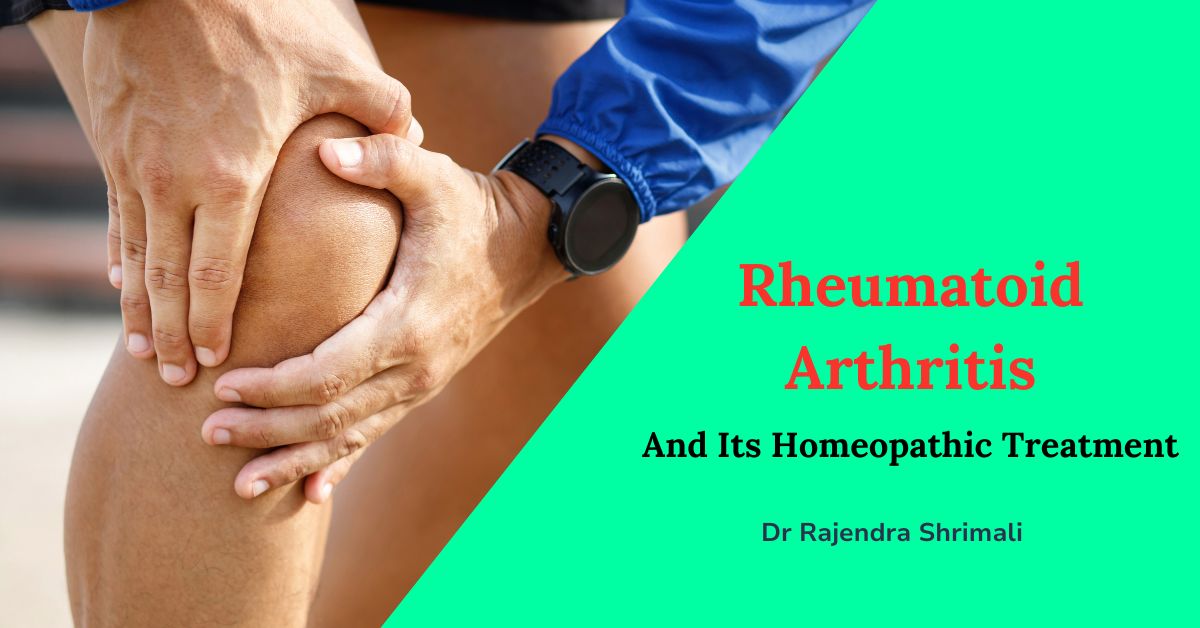 What is Rheumatoid Arthritis AND ITS Homeopathy Treatment