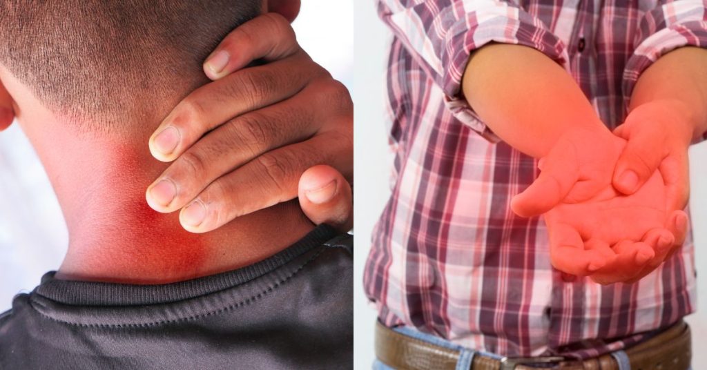 What is Rheumatoid Arthritis AND ITS Homeopathy Treatment